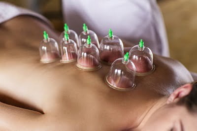 Cupping og massage - Hvordan fungerer denne kombinationsbehandling