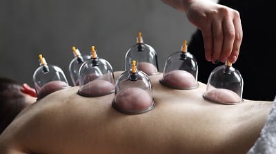 En grundig gennemgang af hvad cupping er og hvad cupping kan