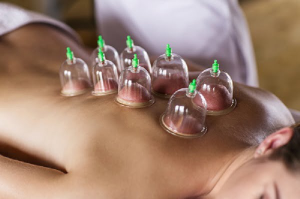 Cupping massage behandling