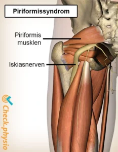 Smerter i ballen og ned i benet